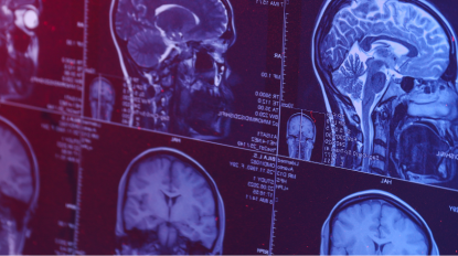 ESPECIALIZAÇÃO AVANÇADA PÓS-UNIVERSITÁRIA EM INTERVENÇÃO NEUROPSICOLÓGICA: avaliação e reabilitação
- Advanced Professional Program -
