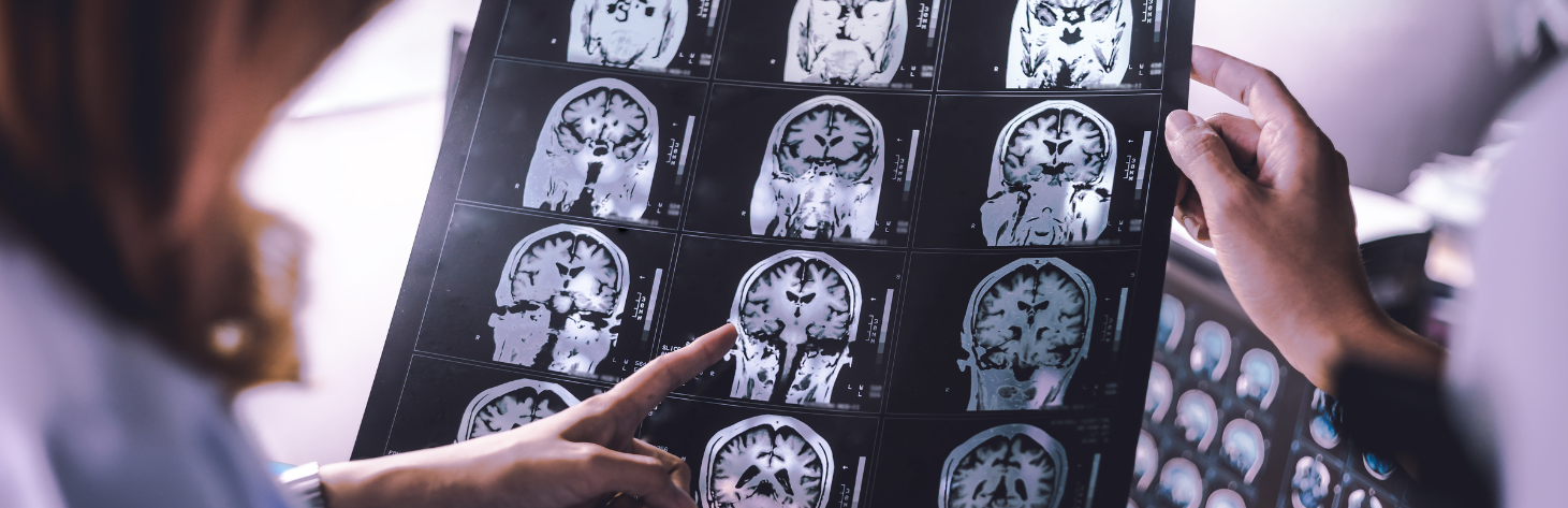 NEUROPSICOLOGIA CLÍNICA