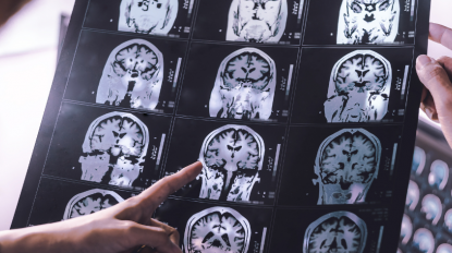 ESPECIALIZAÇÃO AVANÇADA PÓS-UNIVERSITÁRIA EM NEUROPSICOLOGIA CLÍNICA: do diagnóstico ao tratamento
- Advanced Professional Program -